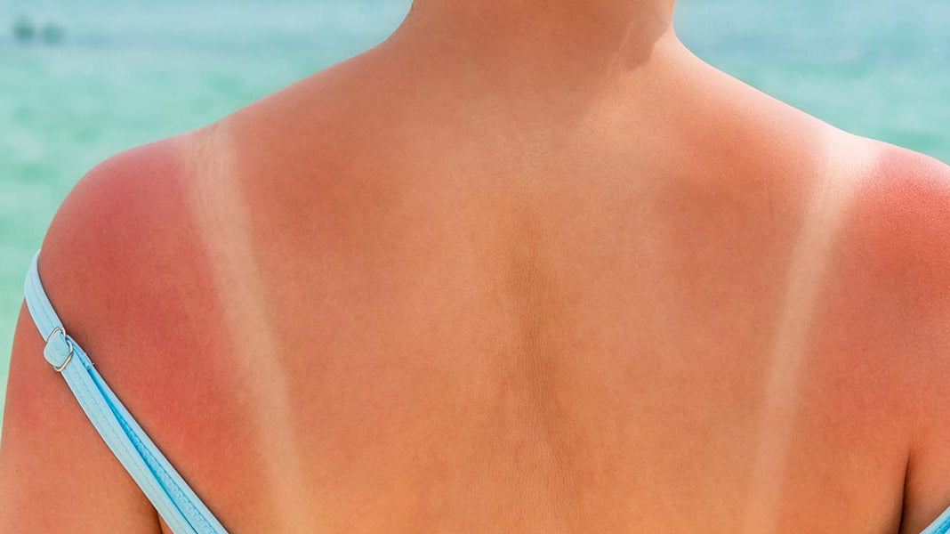 Sunburn Super Heros - Elliotti