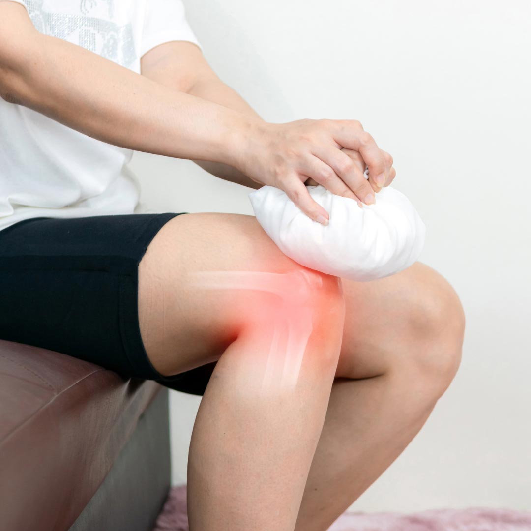 A woman holding a cold compress on an injury to her knee